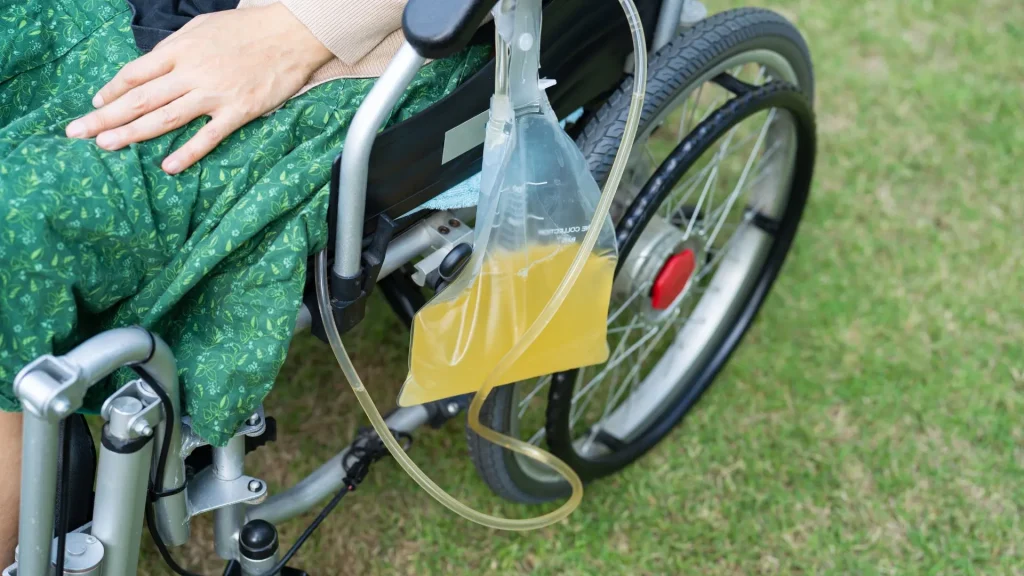 Urine transport bag sering dipandang hanya sebagai kantong plastik biasa, padahal kualitasnya sangat menentukan validitas hasil laboratorium.