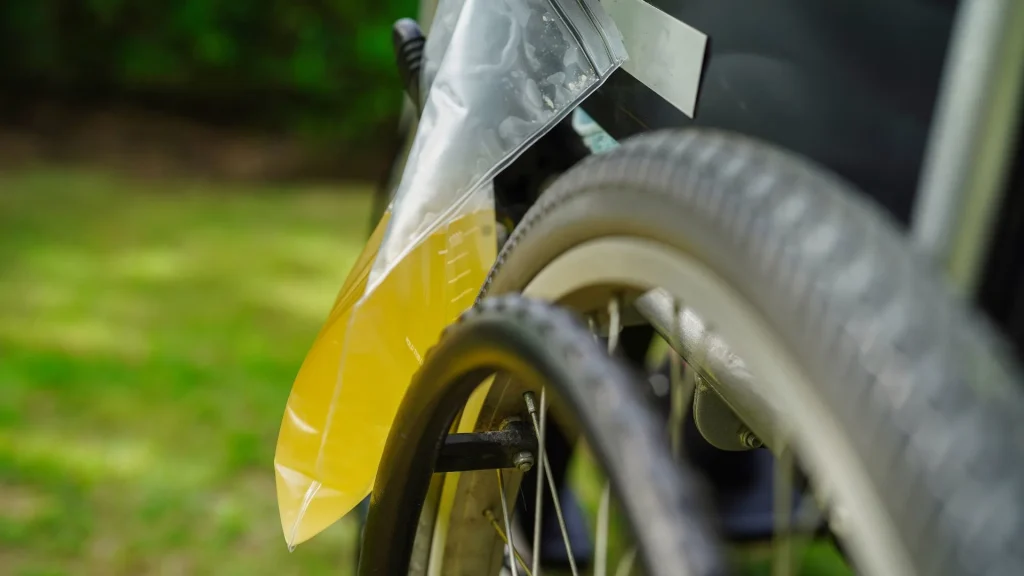 Pengiriman sampel urin merupakan salah satu tahap penting dalam proses diagnostik medis.