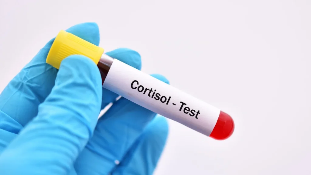 Stres merupakan kondisi yang sering dianggap sepele, padahal dapat memberikan dampak besar terhadap kesehatan fisik dan mental.