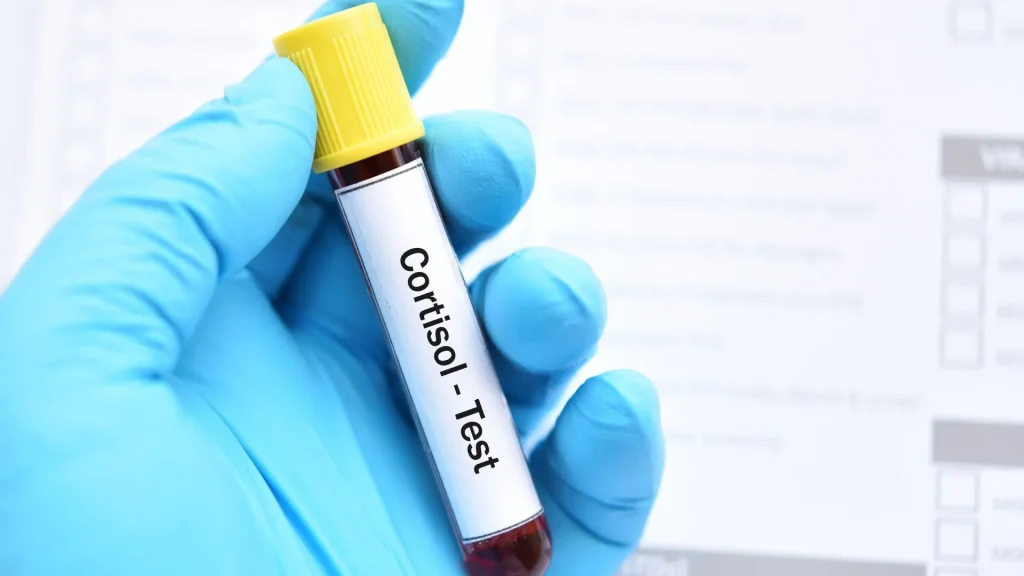 Stres sering dianggap sekadar kondisi psikologis, padahal sesungguhnya berkaitan erat dengan keseimbangan hormon di dalam tubuh.