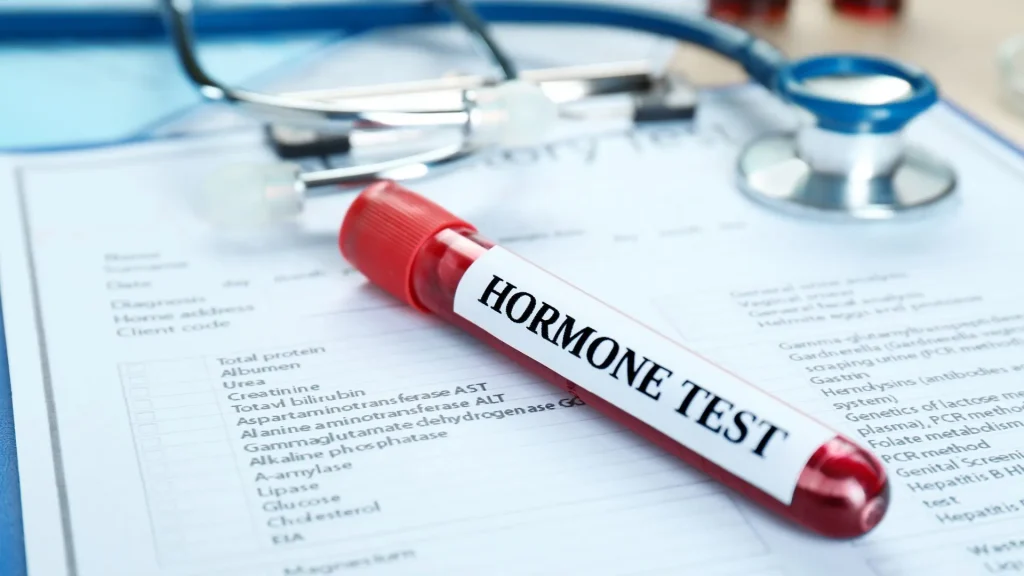 Salivary hormone test adalah metode pemeriksaan yang menggunakan sampel air liur untuk mengukur kadar hormon tertentu.