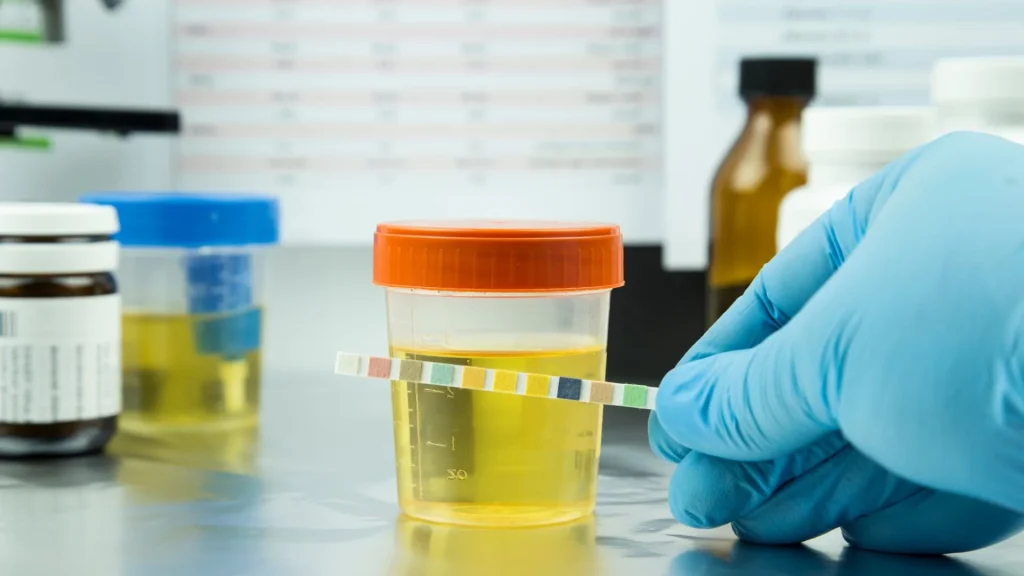 Urinometer adalah alat sederhana berbentuk silinder dengan skala pengukur, digunakan untuk mengukur berat jenis urin.