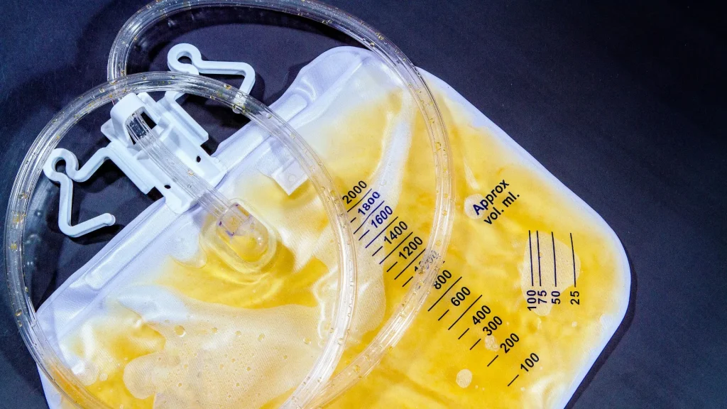 Urinometer merupakan alat sederhana namun bermanfaat dalam menilai berat jenis urin.