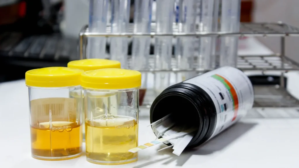 Meskipun urinometer tampak sederhana, penggunaannya membutuhkan ketelitian.