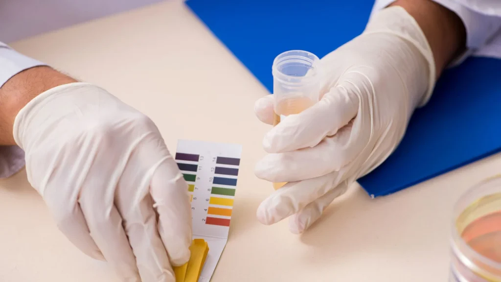 pH urine yang normal berkisar antara 4,5 hingga 8. Nilai ini mencerminkan keseimbangan asam basa dalam tubuh dan dapat menjadi indikator awal adanya gangguan metabolik, infeksi, atau masalah ginjal.