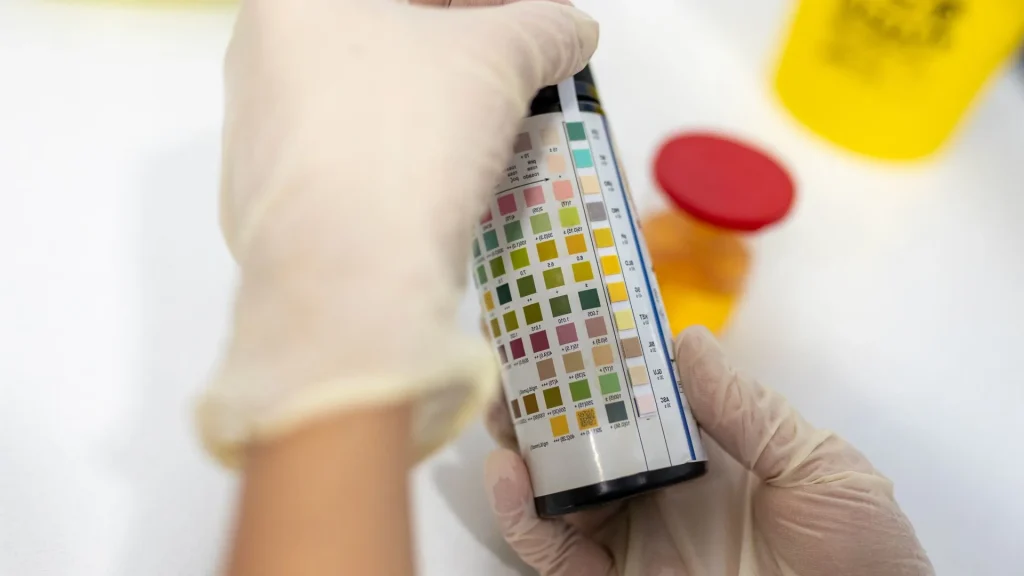 Glomerulus adalah jaringan pembuluh darah kecil dalam ginjal yang bertugas menyaring limbah dari darah.