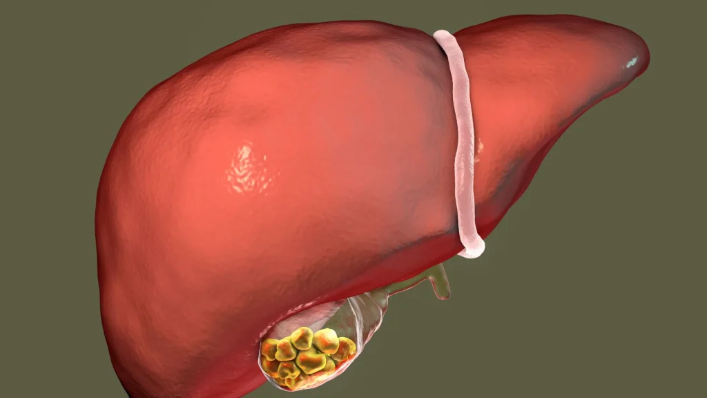 Empedu adalah cairan berwarna hijau kekuningan yang diproduksi oleh hati dan disimpan di kantong empedu.