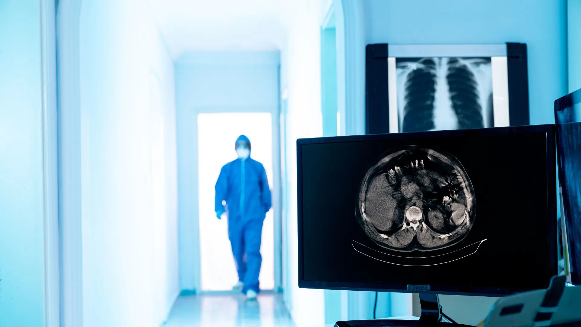 Peningkatan Produktivitas Radiologi dengan Integrasi PACS & RIS - GRIN ...