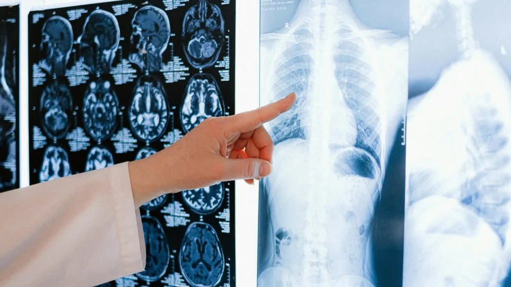 Perkembangan radiologi digital telah mengubah cara hasil X-Ray didistribusikan.