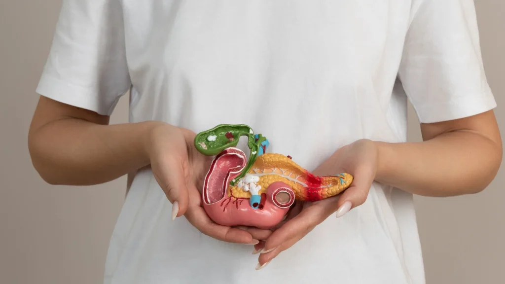 Batu empedu terbentuk ketika cairan empedu di dalam kantong empedu mengalami ketidakseimbangan.