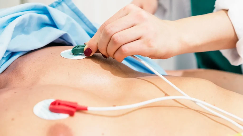 Elektrokardiogram (ECG) adalah alat penting untuk memantau aktivitas listrik jantung.