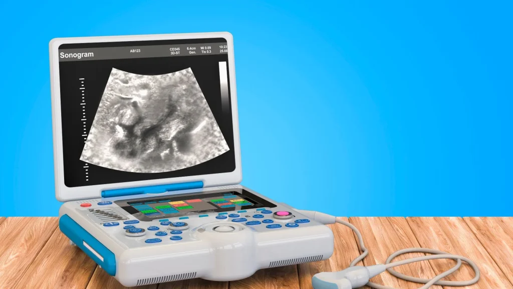 Portable ultrasound merupakan perangkat pencitraan medis yang dapat digunakan secara fleksibel di berbagai tempat, termasuk klinik, rumah sakit kecil, hingga layanan kesehatan berbasis rumah.