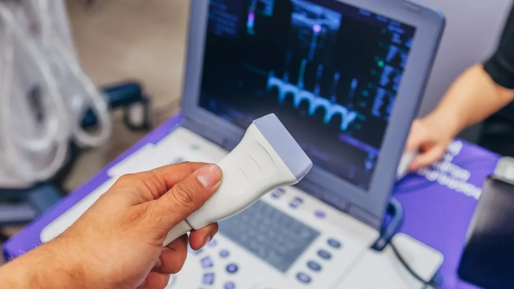 Portable ultrasound adalah perangkat medis modern yang dirancang untuk memberikan kemudahan dalam melakukan pemeriksaan kehamilan.