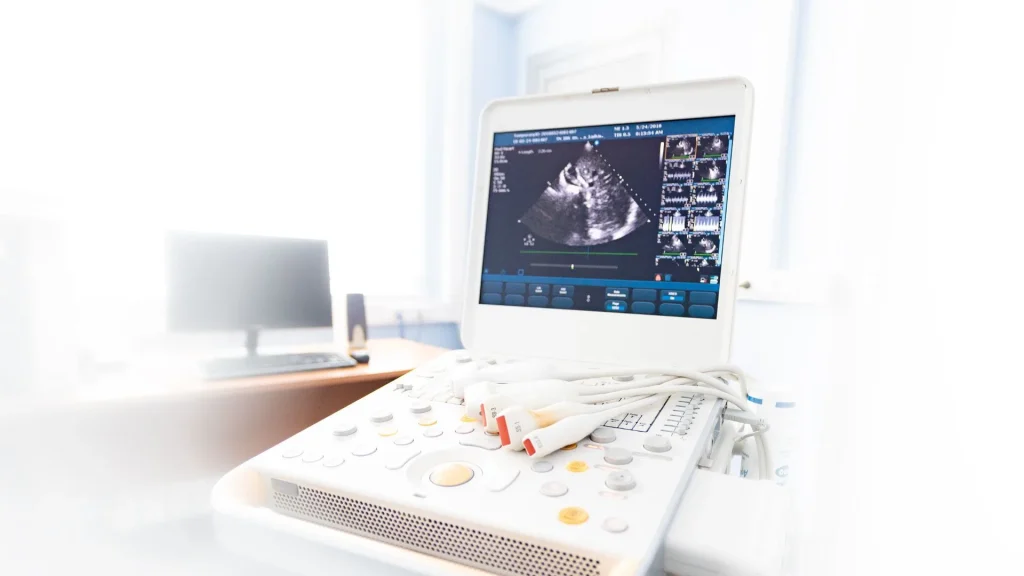 USG merupakan alat diagnostik yang telah lama digunakan dalam dunia medis, khususnya dalam pemeriksaan kehamilan.