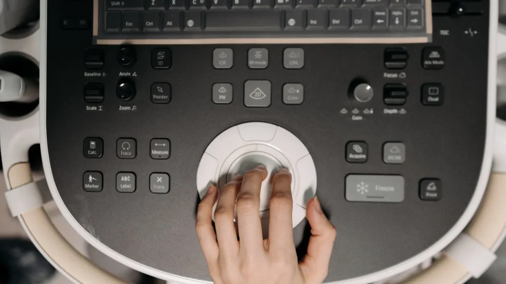 USG merupakan salah satu alat diagnostik yang paling sering digunakan dalam dunia medis, terutama untuk pemeriksaan kehamilan.