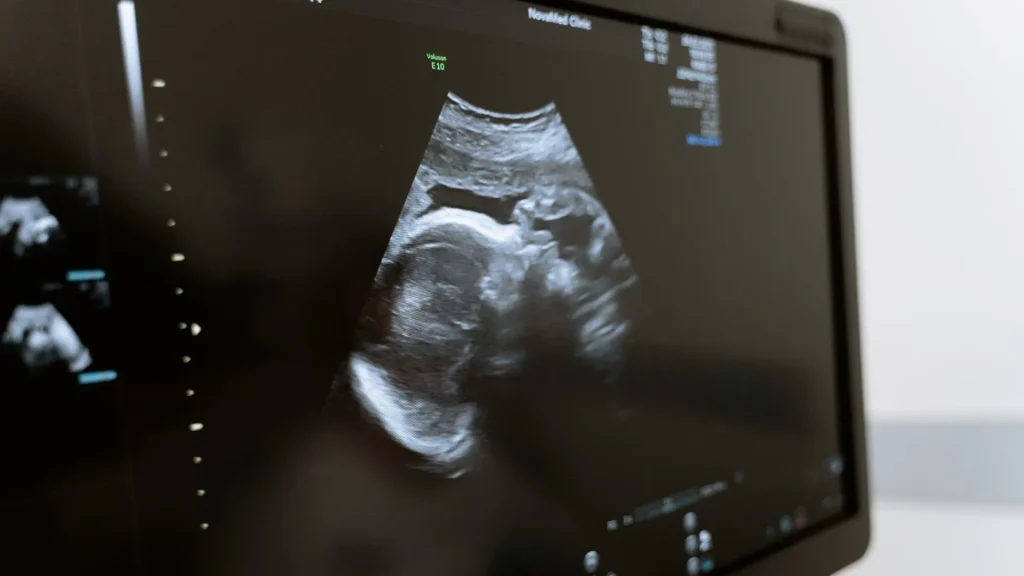 USG portable berperan penting dalam layanan home care obstetri karena memungkinkan pemeriksaan kehamilan dilakukan langsung di rumah pasien.