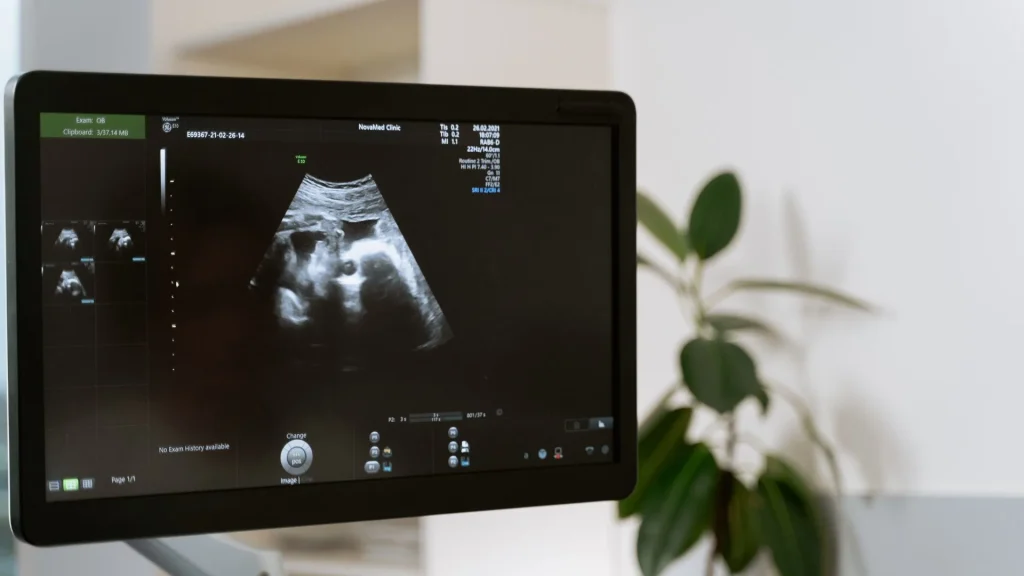 Portable ultrasound telah menjadi solusi praktis dalam pelayanan medis modern, namun tantangan terbesar yang masih dihadapi adalah kualitas gambar yang dihasilkan.