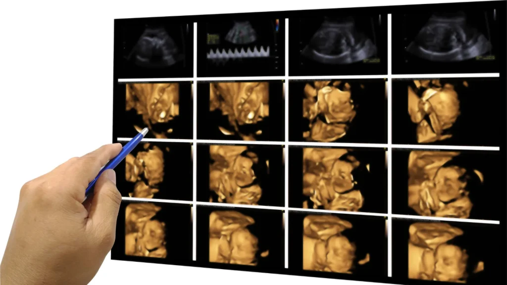 USG 4D portable adalah inovasi medis yang menghadirkan kemampuan visualisasi organ secara real-time dengan perangkat yang ringkas dan mudah dibawa.