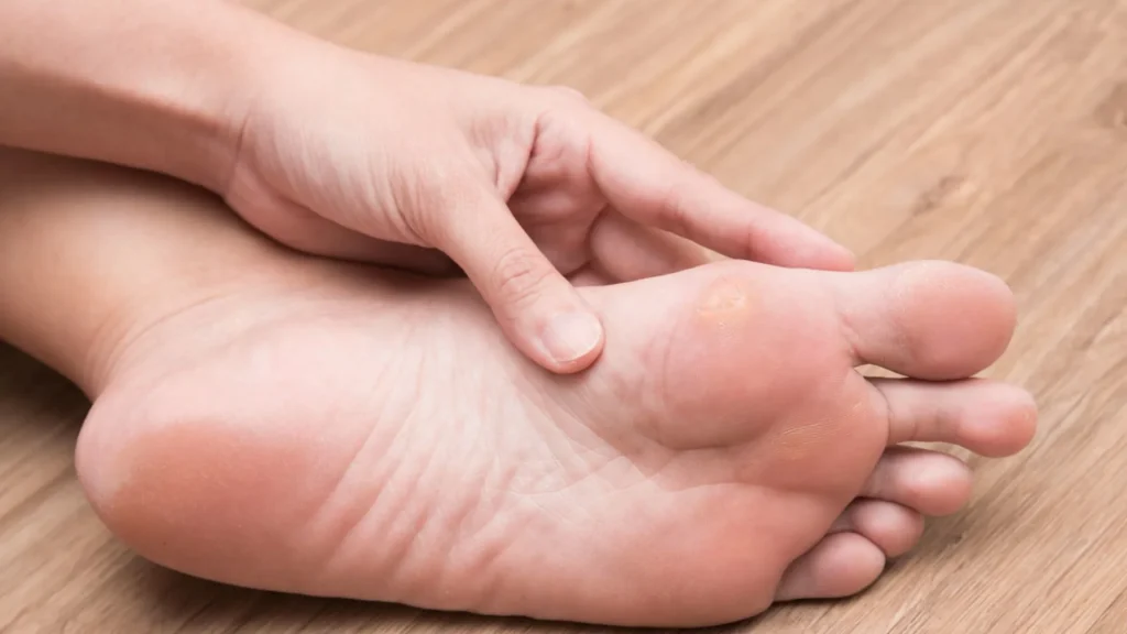 Mata ikan yang membandel sering kali sulit diatasi dengan cara alami atau perawatan rumahan.