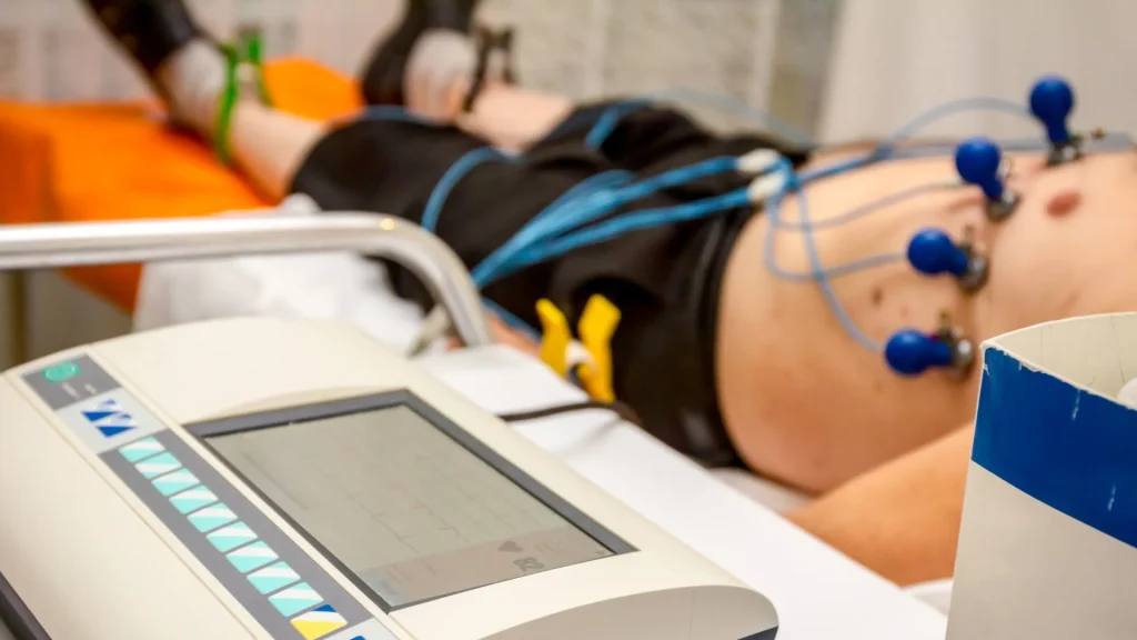 Elektrokardiogram atau ECG adalah alat penting dalam dunia medis untuk mendeteksi aktivitas listrik jantung.