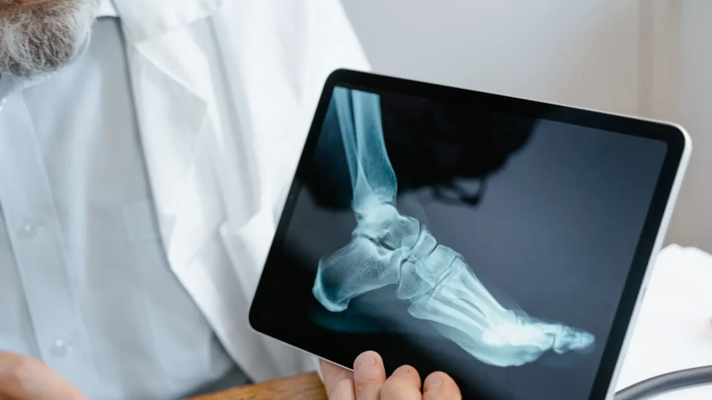 X-ray adalah salah satu metode pencitraan medis tertua yang masih digunakan hingga saat ini.