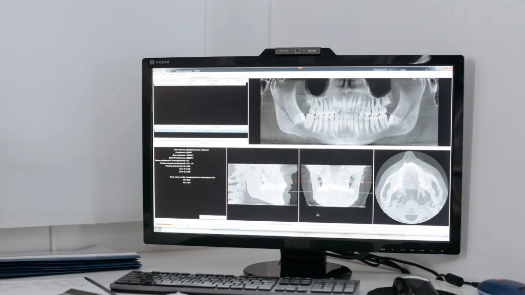 X-ray adalah salah satu teknologi pencitraan medis yang paling sering digunakan untuk mendiagnosis berbagai penyakit.