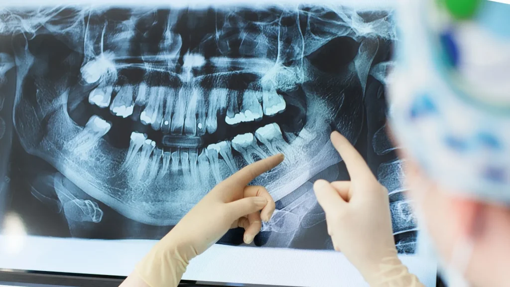 X-ray adalah teknik pencitraan medis yang menggunakan radiasi untuk melihat struktur dalam tubuh.