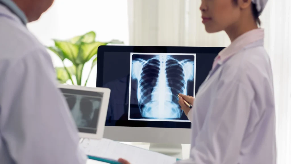 X-ray digital adalah inovasi terbaru dalam dunia radiologi yang dirancang untuk menggantikan sistem film konvensional.