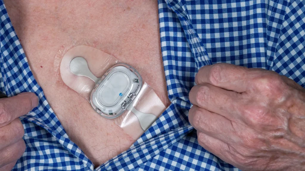 Portable ECG adalah alat medis sederhana yang digunakan untuk merekam aktivitas listrik jantung.