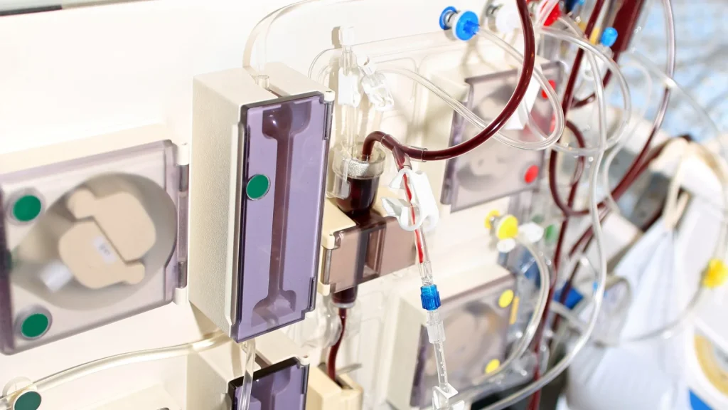 Hemodialisis modern telah mengalami kemajuan pesat dalam hal keamanan pasien, terutama dalam mencegah risiko infeksi.