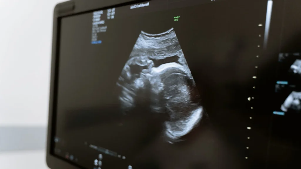 Banyak desa menghadapi keterbatasan fasilitas kesehatan, termasuk minimnya alat diagnostik.