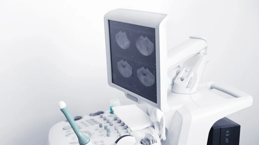Citra USG seringkali memiliki keterbatasan resolusi dan noise yang dapat mengganggu akurasi diagnosis.
