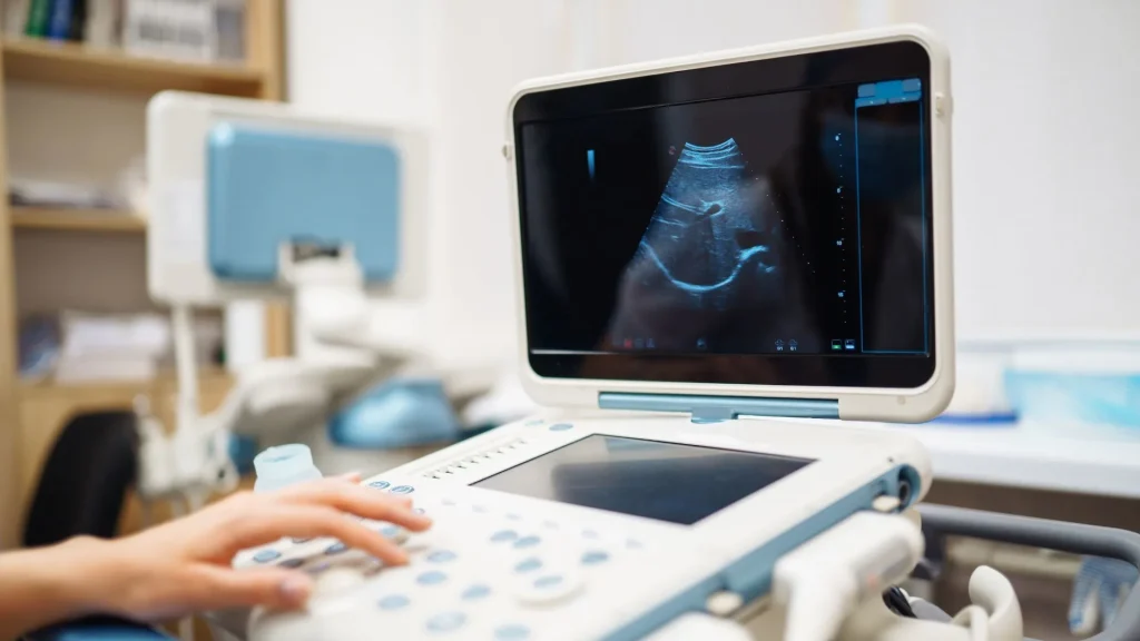 Portable ultrasound menjadi inovasi penting dalam upaya pemerataan layanan kesehatan,