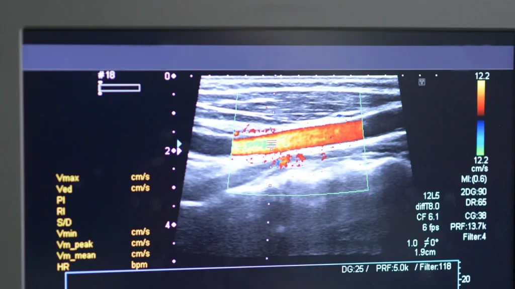 Kecerdasan buatan atau AI kini mulai banyak diterapkan dalam teknologi USG untuk mendukung diagnosis medis.
