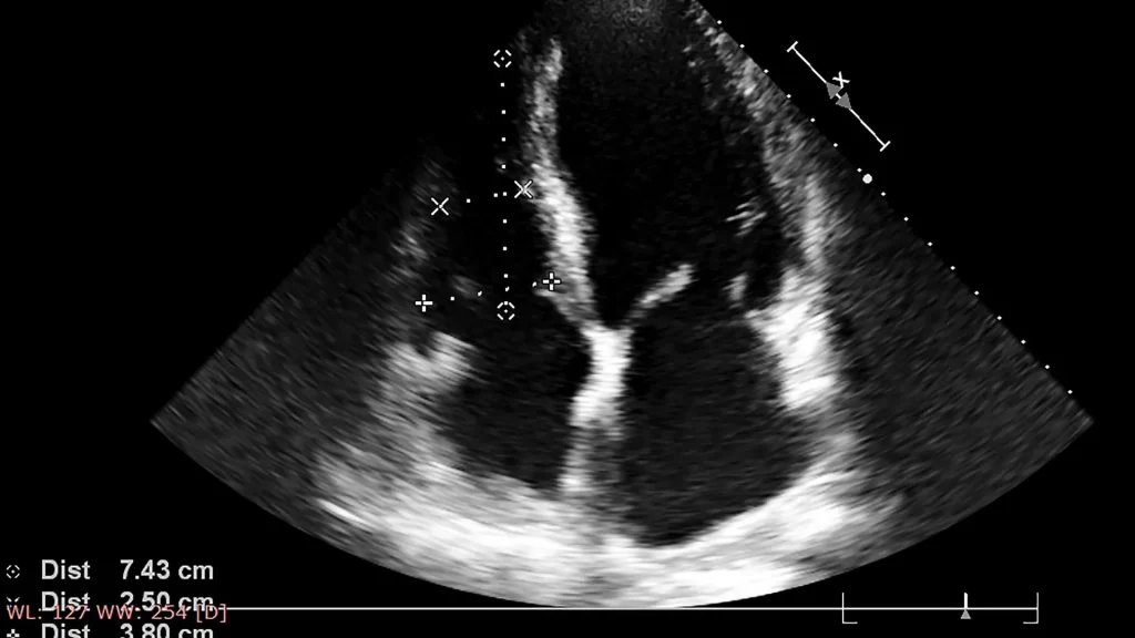Kecerdasan buatan (AI) kini memainkan peran penting dalam dunia pencitraan medis, termasuk ultrasound.