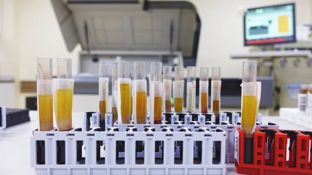 Dalam sistem laboratorium modern, integrasi antara Laboratory Information System (LIS) dan analyzer otomatis menjadi fondasi utama workflow yang efisien.