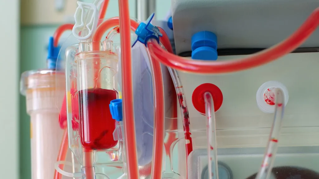 Perkembangan teknologi kedokteran telah membawa mesin hemodialisis ke era baru yang lebih aman dan cerdas.