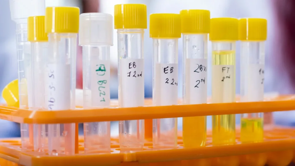 Analyzer otomatis merupakan alat vital di laboratorium medis yang memerlukan perawatan rutin agar tetap berfungsi optimal.