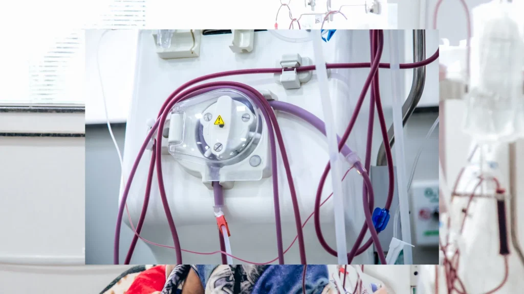 Mesin dialisis modern merupakan perangkat medis yang berfungsi menggantikan sebagian kerja ginjal dalam menyaring darah.