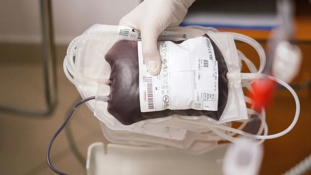 Mesin hemodialisis modern merupakan perangkat medis yang dirancang untuk menggantikan fungsi ginjal dalam menyaring darah secara efisien.