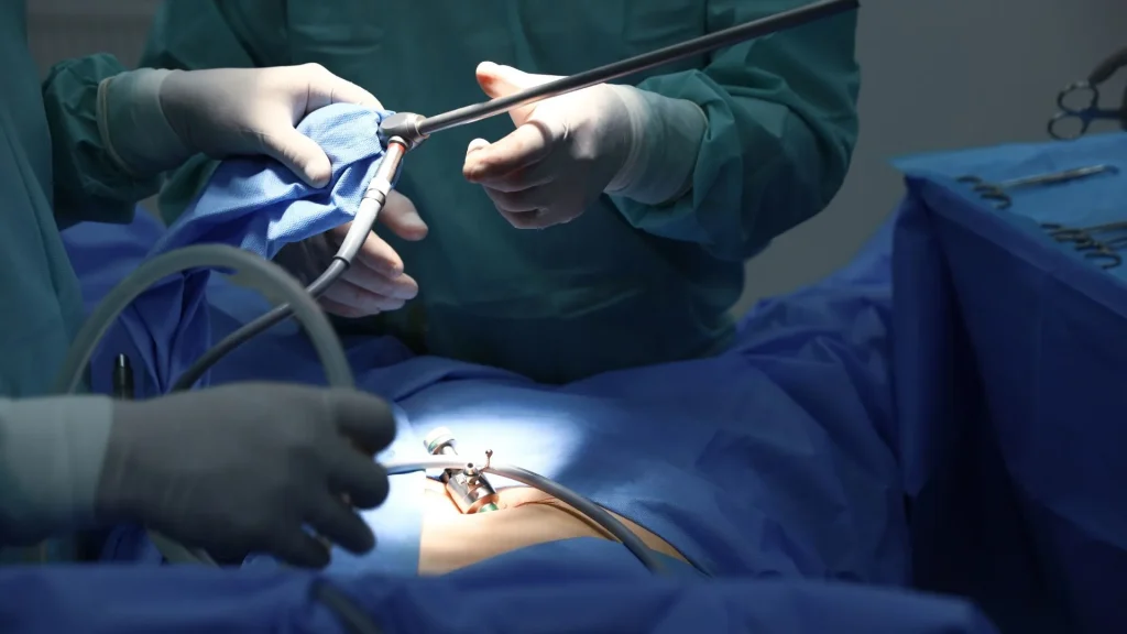 Bedah laparoskopi membutuhkan serangkaian alat khusus yang dirancang untuk melakukan tindakan pembedahan melalui sayatan kecil.