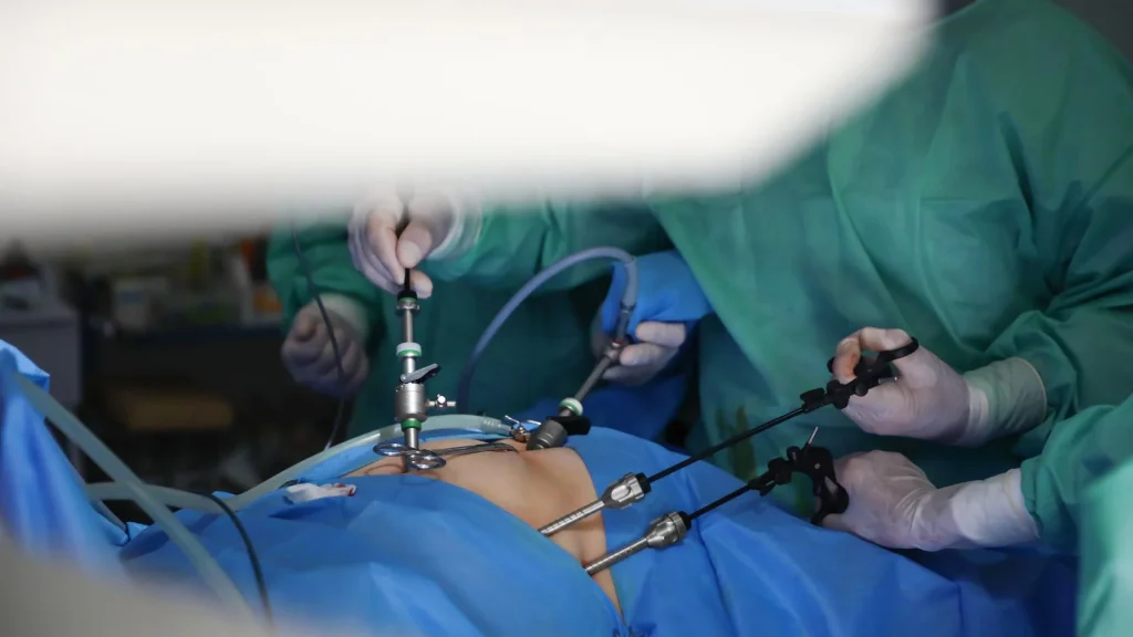 Waktu pemulihan menjadi salah satu keunggulan utama yang membedakan laparoskopi dari operasi terbuka.