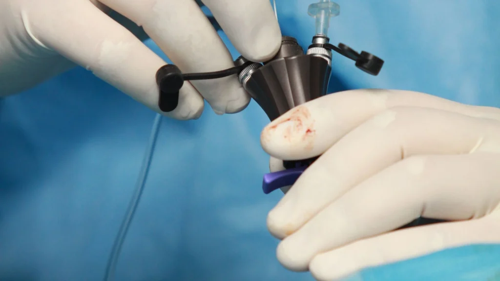 Sejarah bedah laparoskopi dimulai pada awal abad ke-20 ketika para dokter mulai bereksperimen dengan teknik visualisasi rongga tubuh tanpa membuat sayatan besar.