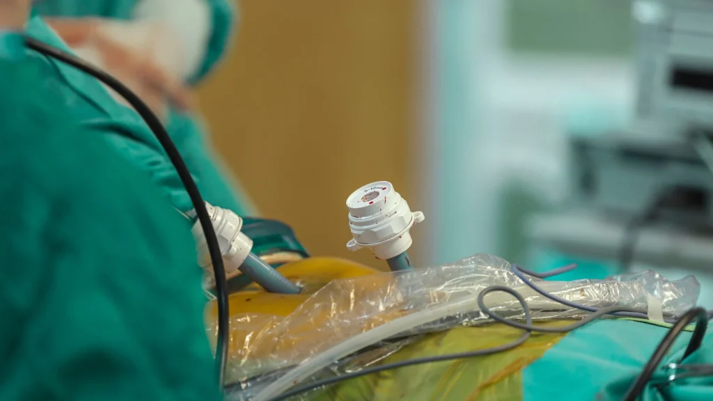 Gas karbon dioksida (CO₂) berperan penting dalam prosedur bedah laparoskopi karena digunakan untuk mengembang­kan rongga perut.