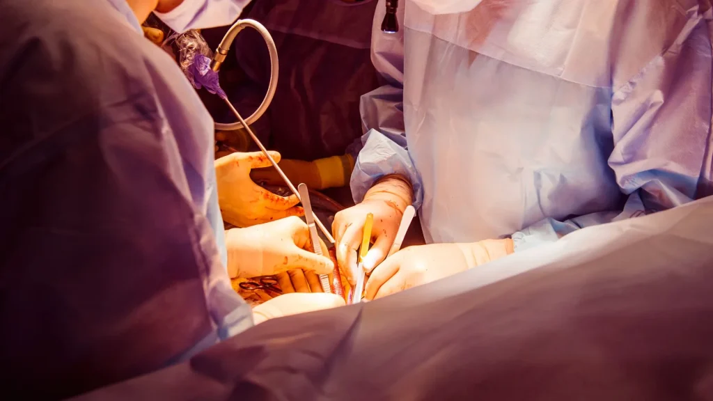 Kamera HD merupakan elemen utama dalam prosedur laparoskopi modern yang berfungsi memberikan pandangan jelas terhadap organ dalam tubuh tanpa harus melakukan sayatan besar.