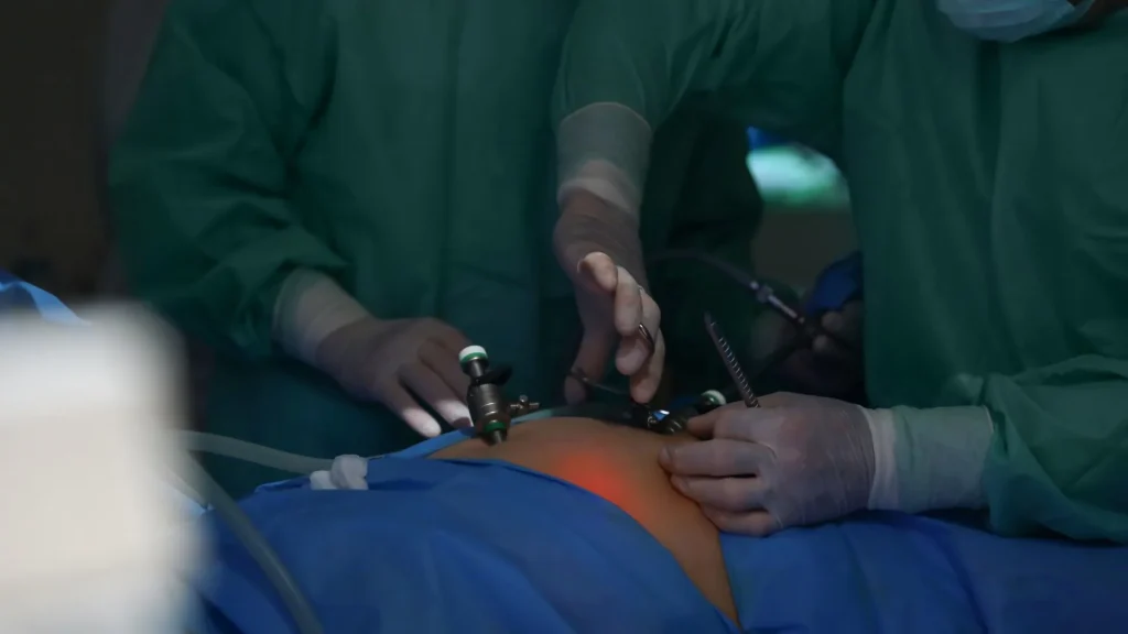 Salah satu manfaat besar dari bedah laparoskopi adalah luka yang sangat kecil dan hampir tidak terlihat setelah penyembuhan.