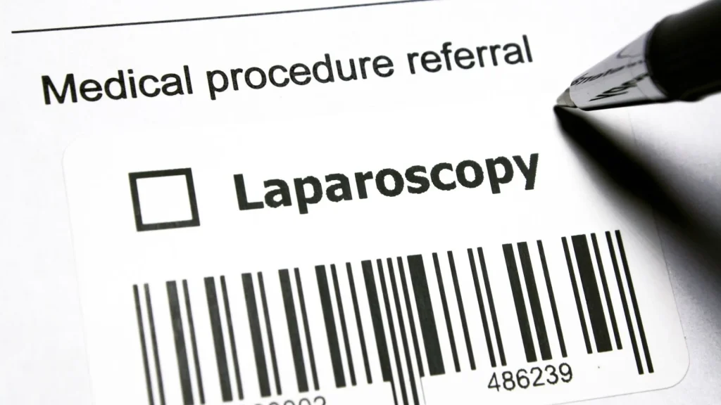 Salah satu perbedaan paling signifikan antara bedah laparoskopi dan operasi terbuka adalah durasi rawat inap di rumah sakit.