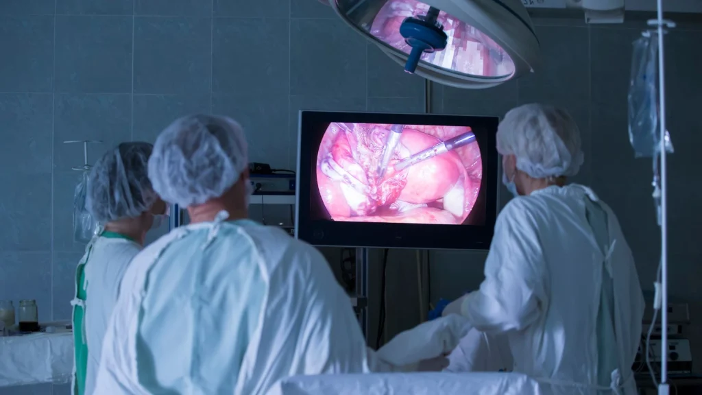 Kemajuan kamera beresolusi tinggi atau HD telah membawa perubahan besar dalam dunia bedah laparoskopi.