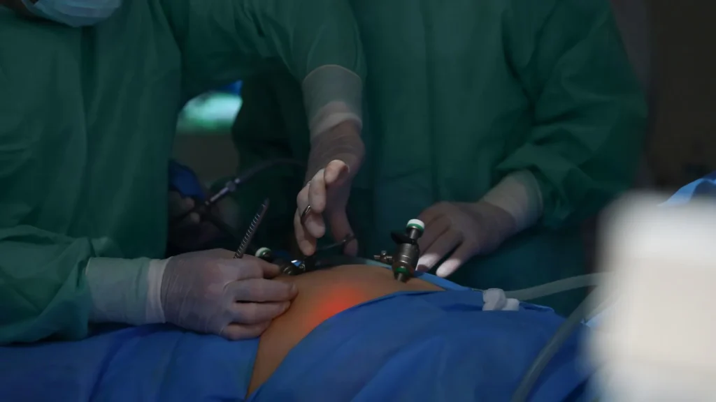 Bedah laparoskopi membawa dampak langsung terhadap efisiensi operasional rumah sakit karena durasi pemulihan pasien jauh lebih singkat dibandingkan dengan operasi konvensional.