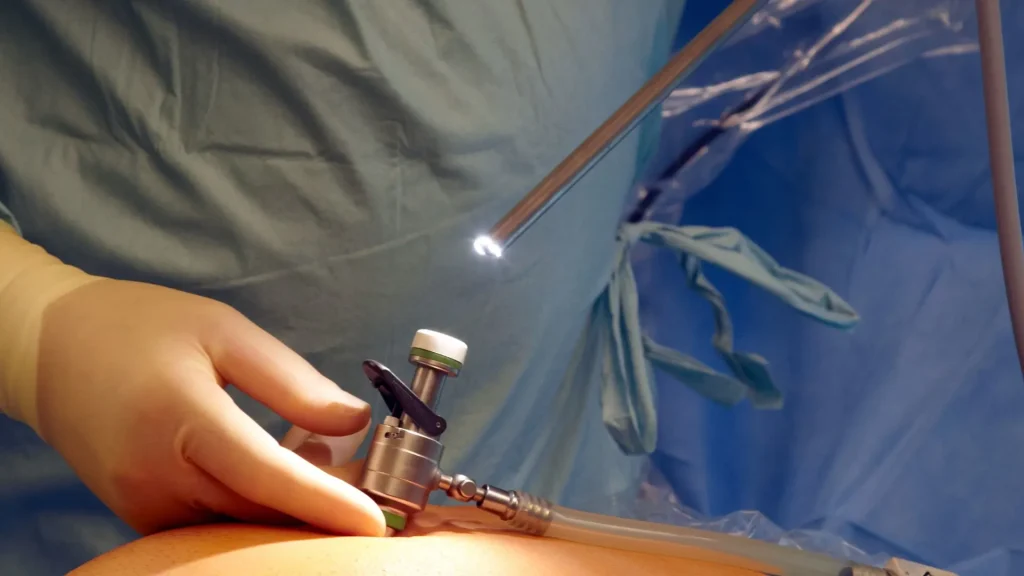 Dalam dunia kedokteran modern, aspek ekonomi menjadi faktor penting dalam menentukan metode pembedahan yang digunakan.